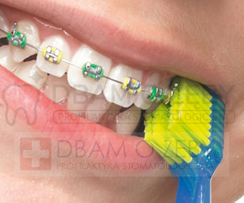 Szczoteczka ortodontyczna Curaprox CS 5460 ultra soft - ORTHO MIX