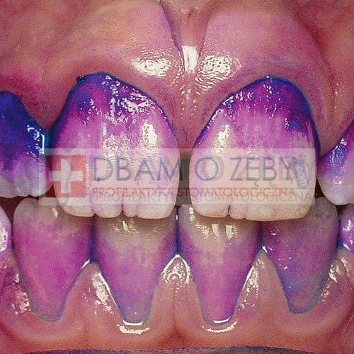 Tabletki do wybarwiania płytki nazębnej Curaprox (12 szt)